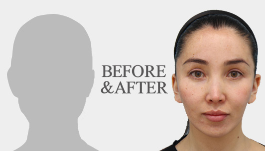 BEFORE＆AFTER