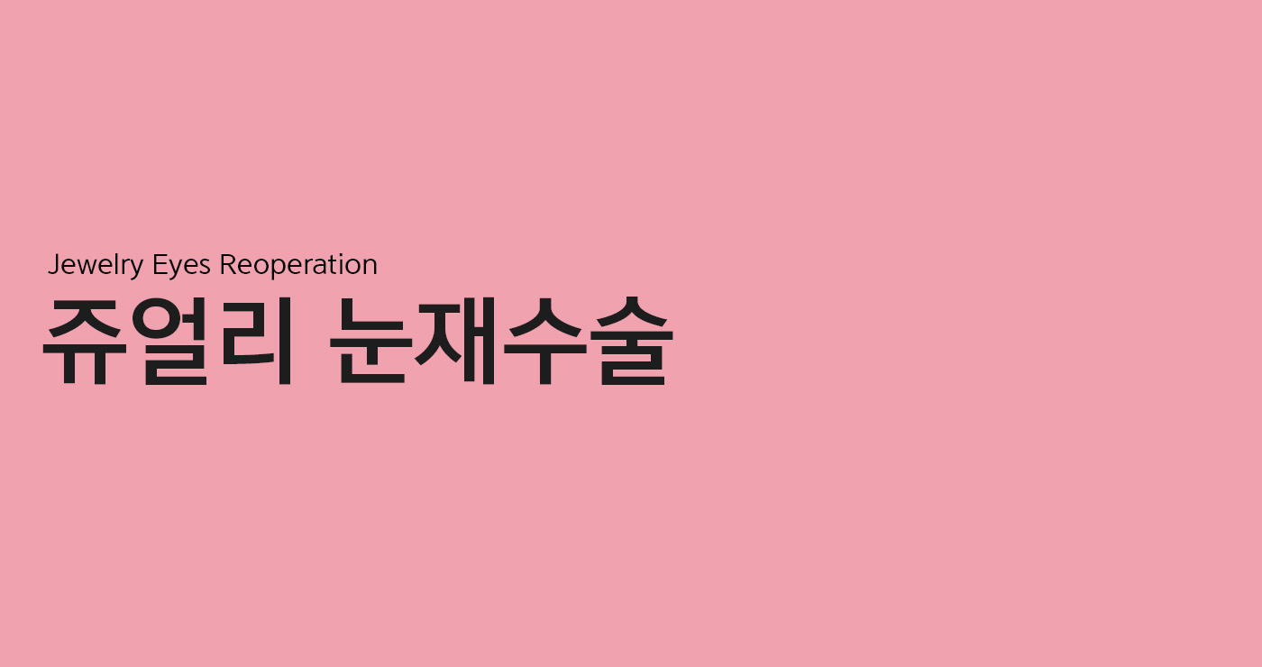 눈재수술 타이틀이미지