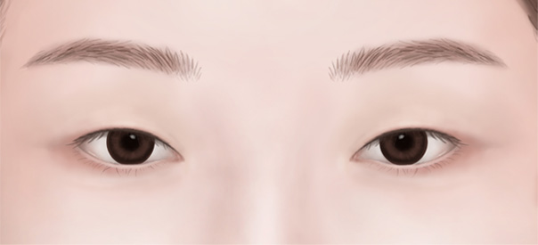Before 눈매