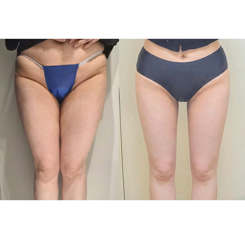 Other procedures at Jewelry Plastic Surgery — Jewelry case #3194