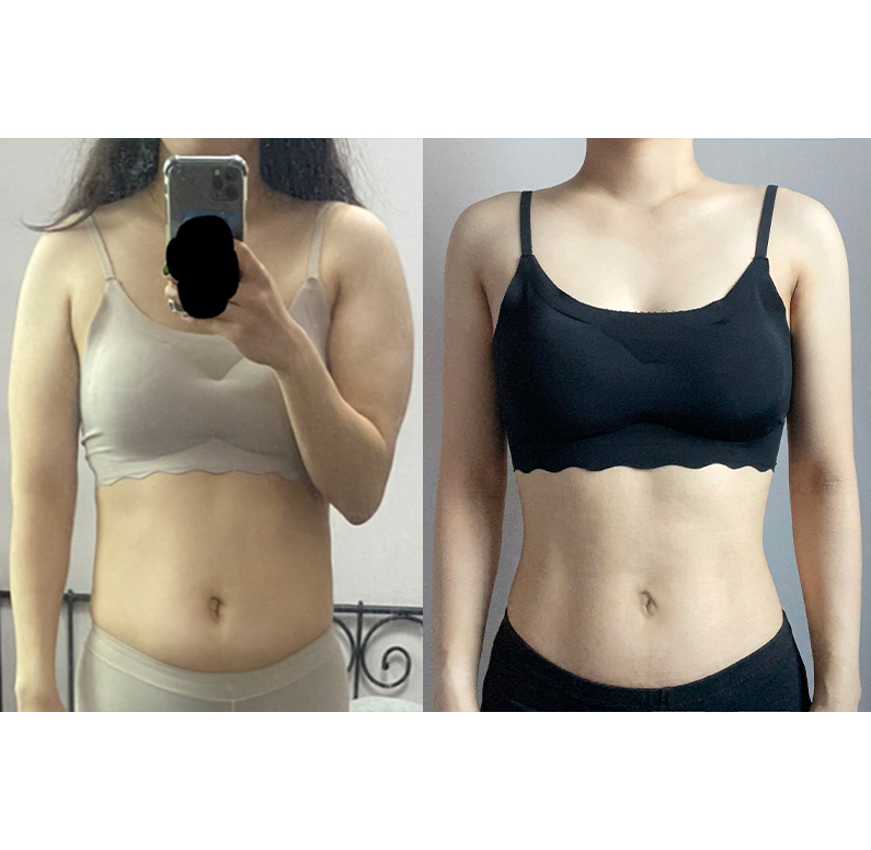 Other procedures at Jewelry Plastic Surgery — Jewelry case #3196