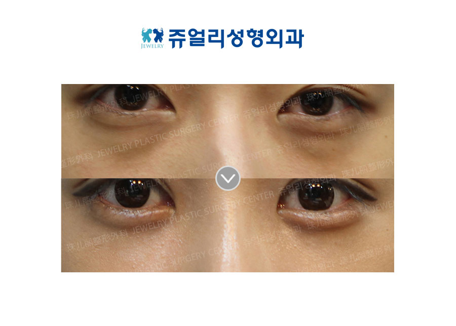 Dark Circles - Loveband