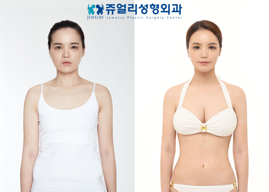Face Surgery, Breast Surgery, Liposuction